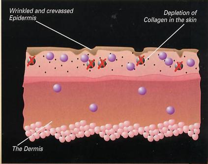 collagen tablets, collagen, type II collagen, collagen supplement, collagen supplements, encore collagen, collagen capsule, collagen capsules, joint pain relief, joint pain help, collagen pills, collagen pills, chicken collagen, soft skin, skin firmer, wrinkle reducer, smooth skin, anti aging natural supplements, anti aging supplements, anti aging skin care, anti aging skin care product, type ii collagen, pure collagen, type 2 collagen, natural collagen, hydrolyzed collagen, antiaging skin care product, remove cellulite, arthritis pain relief, how to get rid of cellulite, stretch marks, how to get rid of stretch marks, botox alternative, natural supplements, collagen powder, antiaging skin care treatment, antiaging supplement, antiaging skin care, antiaging skin care product, antiaging product supplement